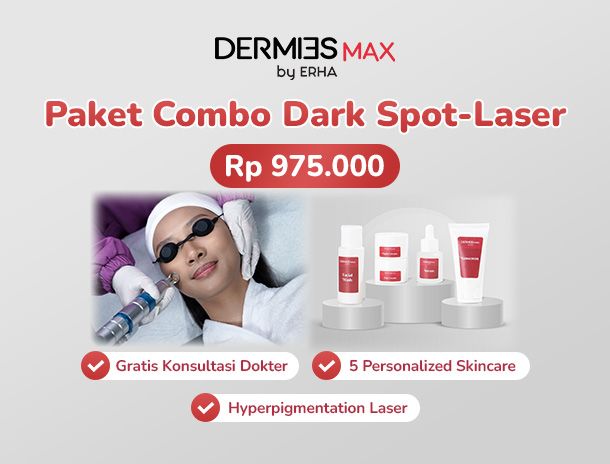 Dark Spot - Laser.jpg
